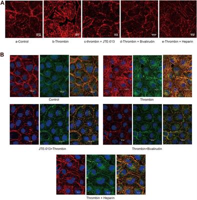 Bivalirudin Attenuates Thrombin-Induced Endothelial Hyperpermeability via S1P/S1PR2 Category: Original Articles